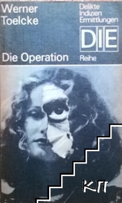 Die operation